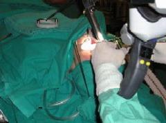 Province of Cuba Introduces CO2 Laser Surgery 